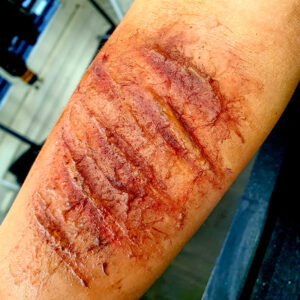 Effet spécial de blessure réaliste en gélatine sur l'avant-bras, maquillage FX pour Halloween ou tournage.